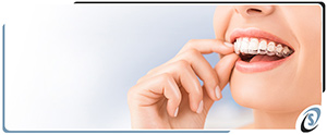 Invisalign Clear Braces Near Me in Toledo, OH Invisalign Clear Braces Near Me in Toledo, OH