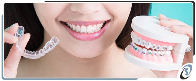 Invisalign vs Braces Near Me in Toledo, OH Invisalign vs Braces Near Me in Toledo, OH