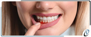 Periodontics Near Me in Toledo, OH Periodontics Near Me in Toledo, OH
