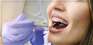 Cost of Braces Near Me in Toledo, Ohio