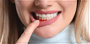 Periodontist Near Me in Toledo, OH Periodontist Near Me in Toledo, OH