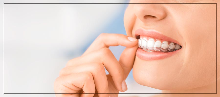 Invisalign Clear Braces Near Me in Toledo, OH