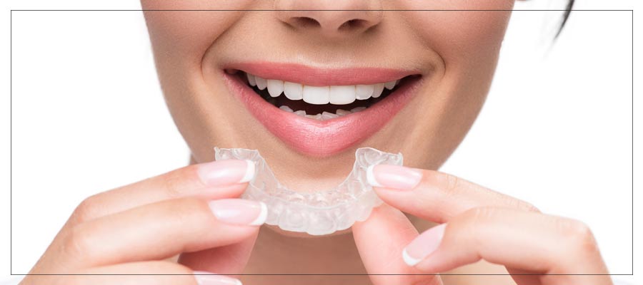 invisalign offers near me