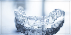 Invisalign Cost Near Me in Toledo, OH