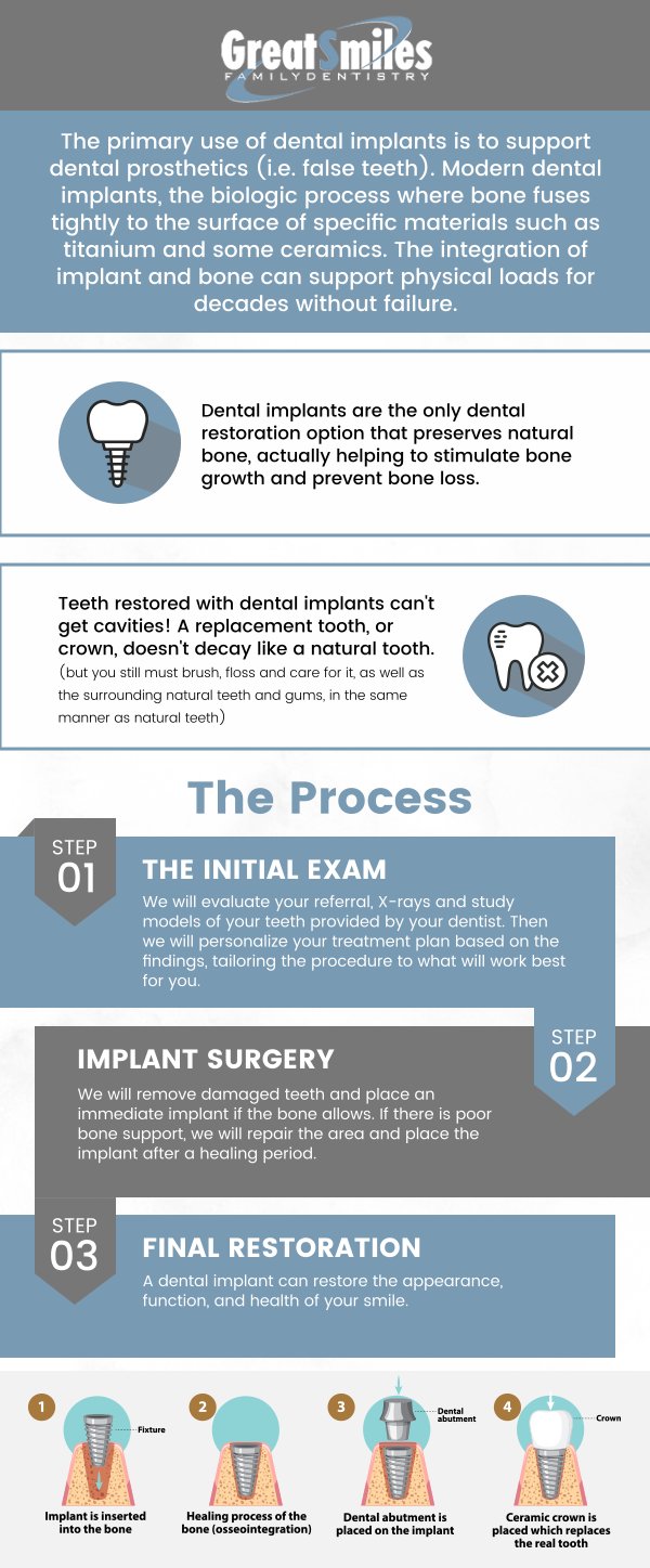 Replace your missing teeth with high-quality implants. Dr. Nadeem Khan, DDS at Greatsmile family Dentistry offered compassionate dental care with effective and long-lasting results. Call us now for more information. We are conveniently located at 4646 Nantuckett Dr Toledo, OH 43623.