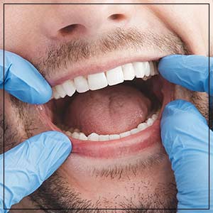 Dental Bridge Specialist Near Me in Toledo, OH