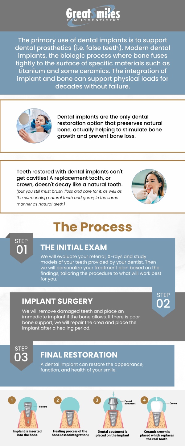 Implant restoration after dental implant placement is the final step where a crown, bridge, or denture is attached to the implant to restore function and appearance. At Great Smiles Family Dentistry with Dr. Nadeem Khan, DDS, ensures your replacement looks natural and blends seamlessly. With proper care, implant restorations provide lasting strength and comfort. For more information, contact us. We are conveniently located at 4646 Nantuckett Dr Suite D, Toledo, OH 43623. Implant restoration after dental implant placement is the final step where a crown, bridge, or denture is attached to the implant to restore function and appearance. At Great Smiles Family Dentistry with Dr. Nadeem Khan, DDS, ensures your replacement looks natural and blends seamlessly. With proper care, implant restorations provide lasting strength and comfort. For more information, contact us. We are conveniently located at 4646 Nantuckett Dr Suite D, Toledo, OH 43623.